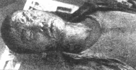 日军对中国军队进行毒气战